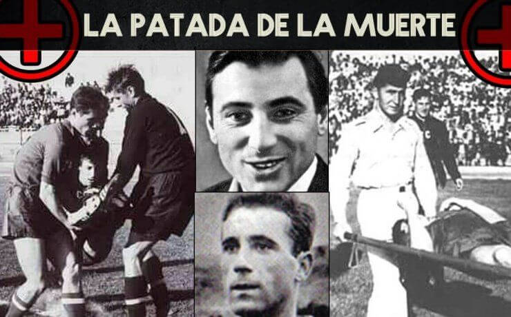Lesion Dubinski Mujic chile 62